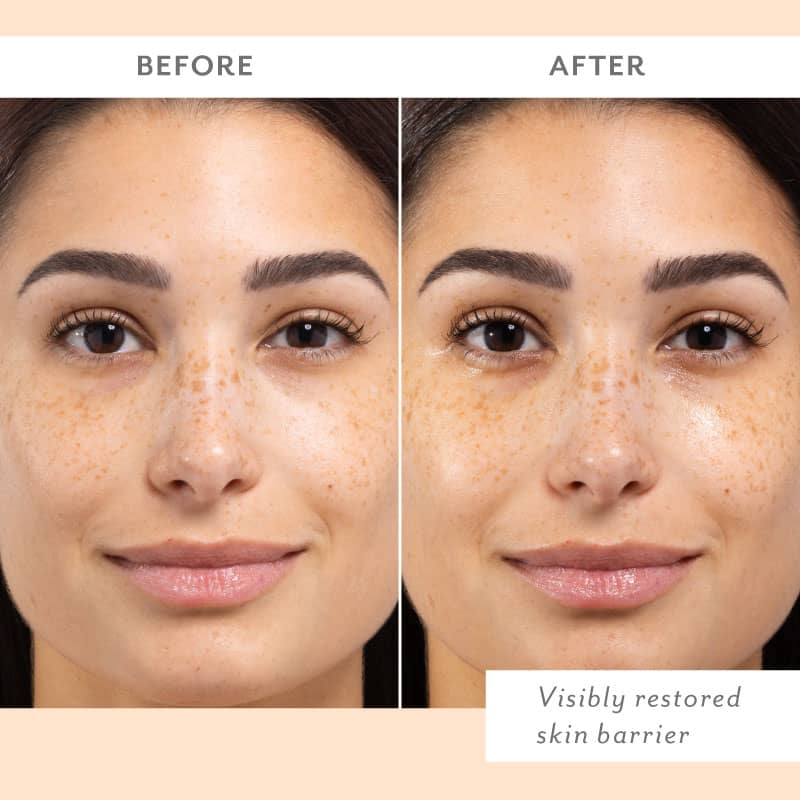 Skin Remedy Barrier-Boosting Sheet Mask